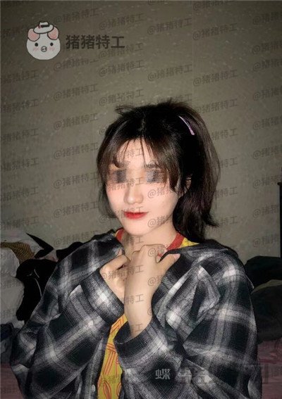上海愉悦美联臣陈红梅面部填充案例价格分享,脸上饱满年轻御姐范儿轻松掌握~