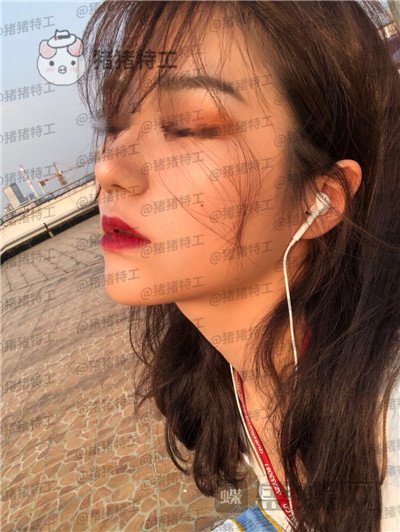 上海愉悦美联臣陈红梅面部填充案例价格分享,脸上饱满年轻御姐范儿轻松掌握~
