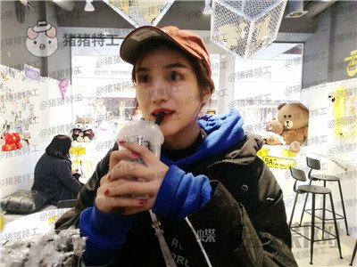 上海愉悦美联臣陈红梅面部填充案例价格分享,脸上饱满年轻御姐范儿轻松掌握~