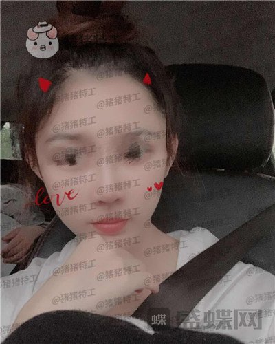 福州星龄黎护忠面部填充案例价格分享,朋友都说我像娜扎仙女太开心了!