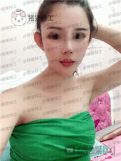 福州星龄黎护忠面部填充案例价格分享,朋友都说我像娜扎仙女太开心了!