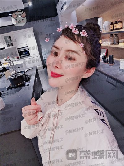 贵阳美贝尔宋俊辉鼻部手术案例价格分享,老阿姨逆袭谈恋爱变美两不误~