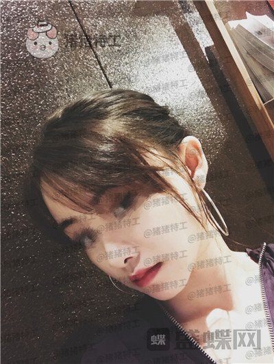 广州美莱张毓面部填充案例价格分享,曾经显凶的脸现在都夸我萌萌哒可爱~