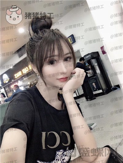成都西区医院肖凌鼻部手术案例价格分享,恕我直言这是混血吗完全看不出是国人~