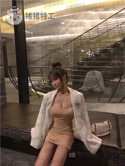 成都西区医院肖凌鼻部手术案例价格分享,恕我直言这是混血吗完全看不出是国人~