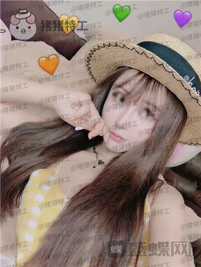 成都西区医院肖凌鼻部手术案例价格分享,恕我直言这是混血吗完全看不出是国人~