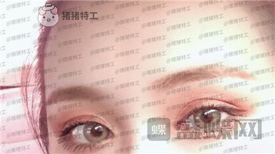 南京美贝尔黄名斗双眼皮案例价格分享,高级脸配备的双眼皮太女神了!