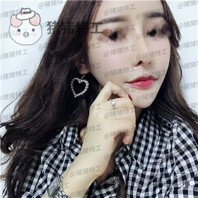 成都军大文科鼻部手术隆鼻案例价格分享,侧颜杀的女神正面同样很迷人~