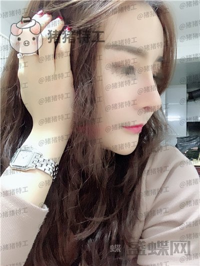 成都军大文科鼻部手术隆鼻案例价格分享,侧颜杀的女神正面同样很迷人~