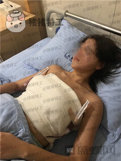 重庆联合丽格党宁隆胸案例价格分享,假体好还是自体脂肪好?适合自己较好。