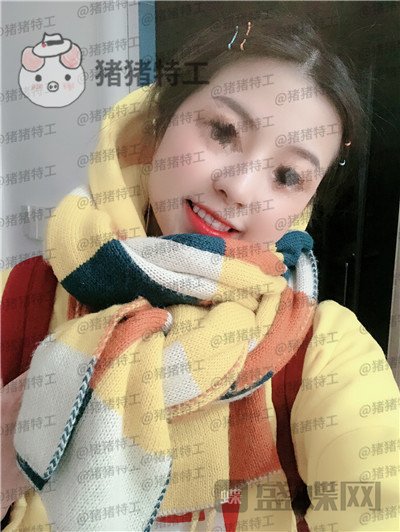 广州曙光蒋思军鼻部手术隆鼻案例价格分享,模特小姐姐对自己的要求太高了!
