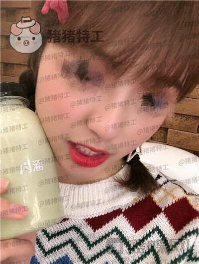 广州曙光蒋思军鼻部手术隆鼻案例价格分享,模特小姐姐对自己的要求太高了!