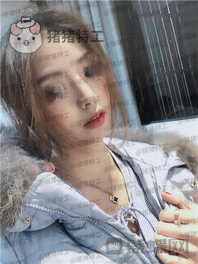 广州曙光蒋思军鼻部手术隆鼻案例价格分享,模特小姐姐对自己的要求太高了!