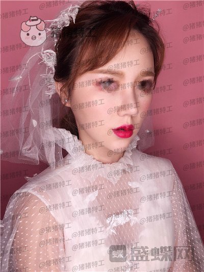 重庆中民孙刚隆鼻案例价格分享,之前的扁脸终于改变了。