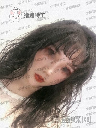 重庆中民孙刚隆鼻案例价格分享,之前的扁脸终于改变了。
