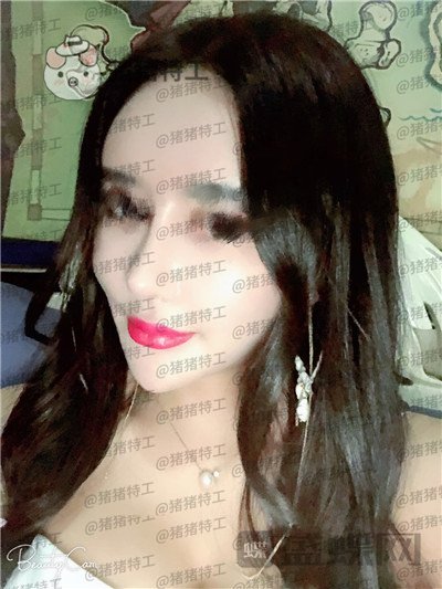 上海喜美王会勇隆鼻修复案例价格分享,跟以前的我比简直天差地别。