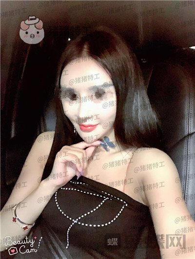 上海喜美王会勇隆鼻修复案例价格分享,跟以前的我比简直天差地别。