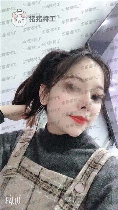 厦门福华金贵香鼻部手术案例价格分享,做完鼻子竟然年轻了这么多?