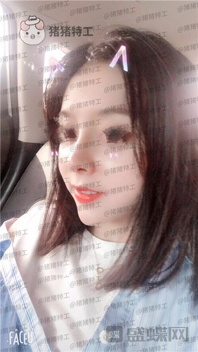厦门福华金贵香鼻部手术案例价格分享,做完鼻子竟然年轻了这么多?