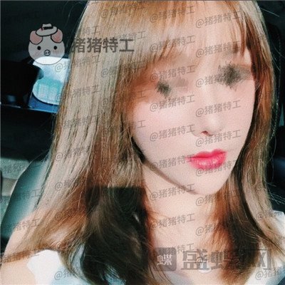 北京百达丽上海九院硕士苏婷隆鼻修复案例价格分享,因为是模特所以对鼻子要求很高。