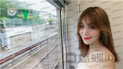 北京百达丽上海九院硕士苏婷隆鼻修复案例价格分享,因为是模特所以对鼻子要求很高。