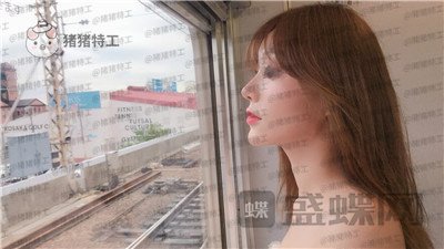 北京百达丽上海九院硕士苏婷隆鼻修复案例价格分享,因为是模特所以对鼻子要求很高。