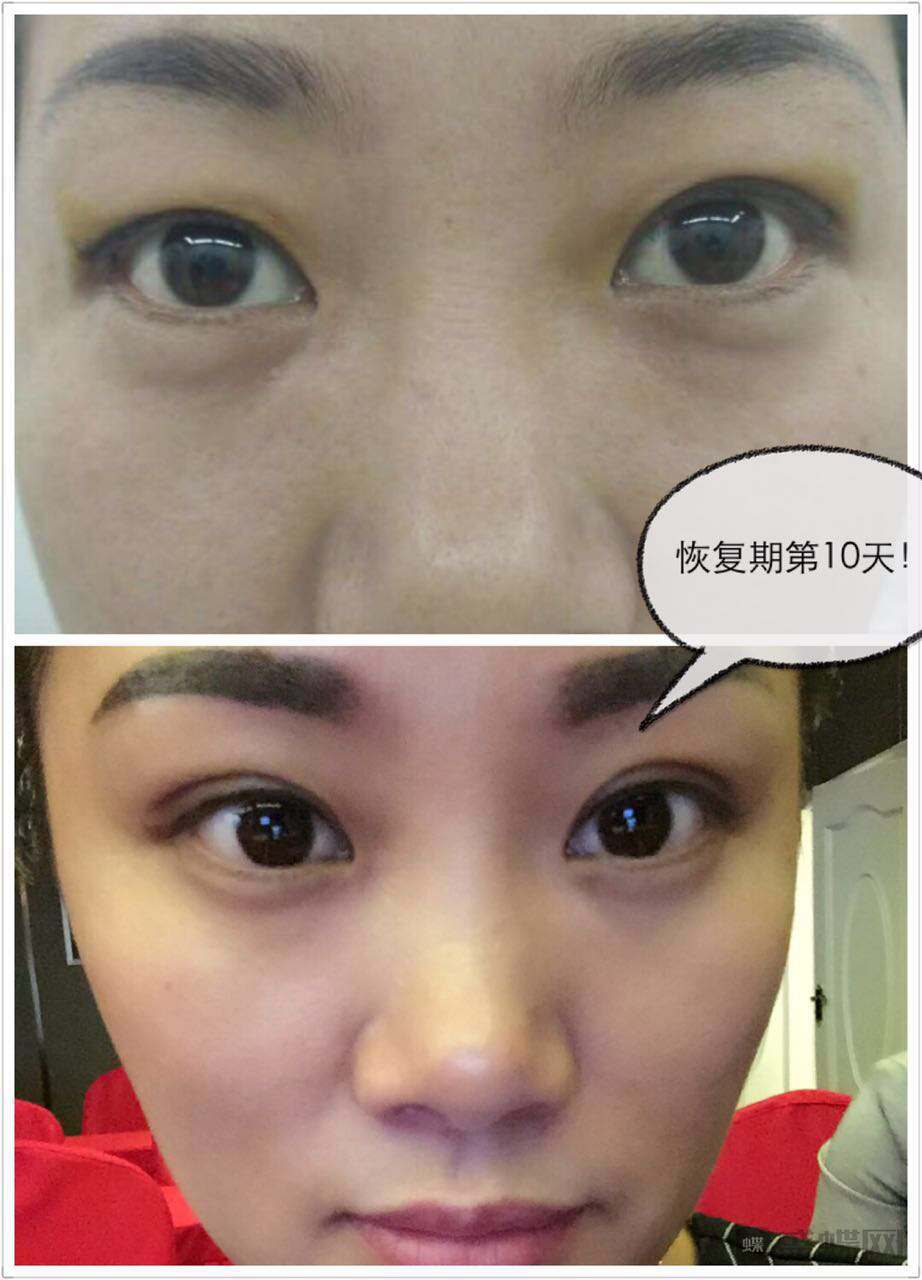 西安艾薇美做整形果好吗?整形案例价格概况