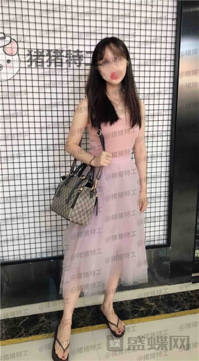 重庆军科赵亚均吸脂案例价格分享，瘦全身真的太快了了夏日queen附身~