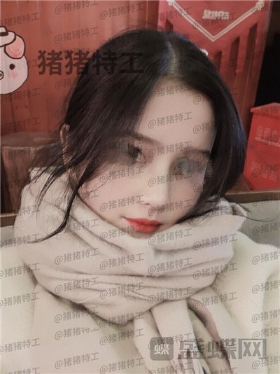 武汉同济曾宁隆鼻案例价格分享,亲戚朋友都说我这个鼻部手术做的值!