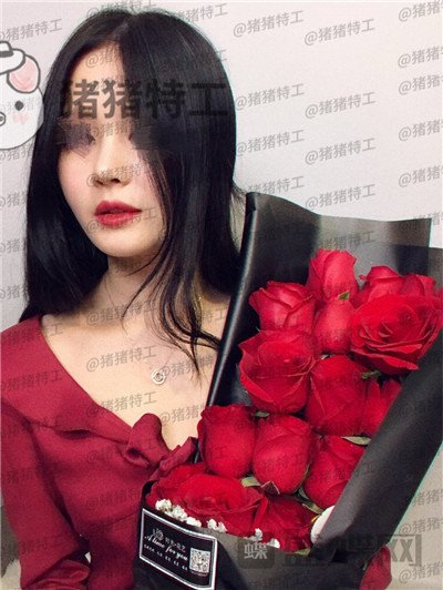 武汉同济曾宁隆鼻案例价格分享,亲戚朋友都说我这个鼻部手术做的值!