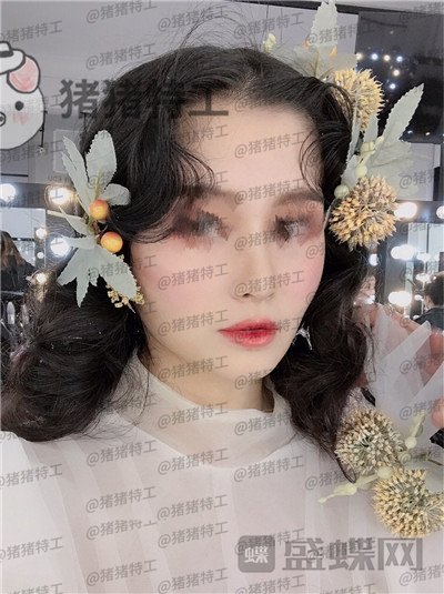 武汉同济曾宁隆鼻案例价格分享,亲戚朋友都说我这个鼻部手术做的值!