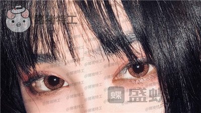 杭州美莱韩超双眼皮案例价格分享,做了眼睛变美享受爱情的滋润一切都很美好~