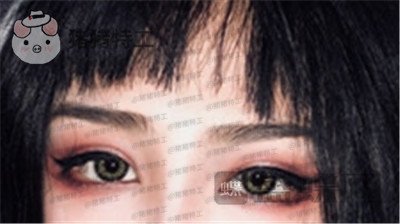 杭州美莱韩超双眼皮案例价格分享,做了眼睛变美享受爱情的滋润一切都很美好~