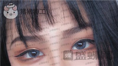 杭州美莱韩超双眼皮案例价格分享,做了眼睛变美享受爱情的滋润一切都很美好~