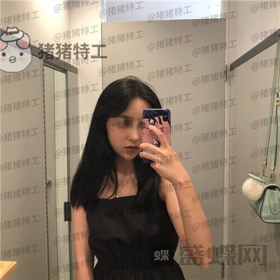 温州伯思立倪锋面部填充案例价格分享,说我现在十八岁没人不信吧!