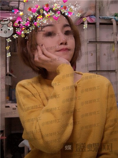 苏州美莱吴蓉鼻部手术案例价格分享,隆鼻一时爽一直美丽一直爽~