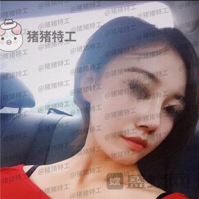 苏州美莱吴蓉鼻部手术案例价格分享,隆鼻一时爽一直美丽一直爽~