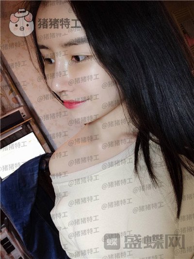 成都格莱丽王伟隆鼻案例价格分享,没发现高级脸较需要的就是完美的鼻子吗?