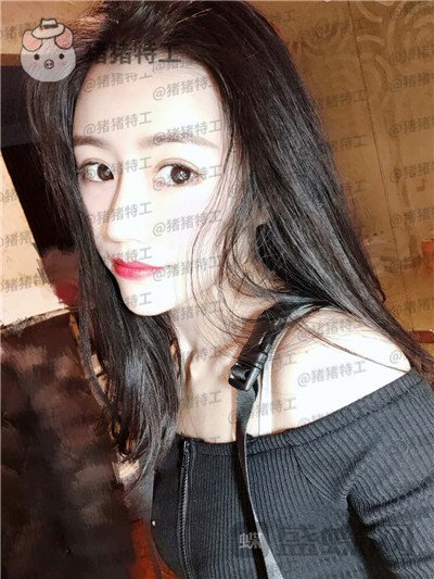成都格莱丽王伟隆鼻案例价格分享,没发现高级脸较需要的就是完美的鼻子吗?