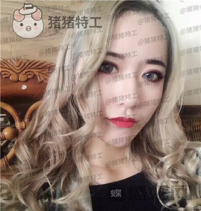 武汉华美马行鼻部手术案例价格分享,一个好看的鼻子有多重要看了就知道!