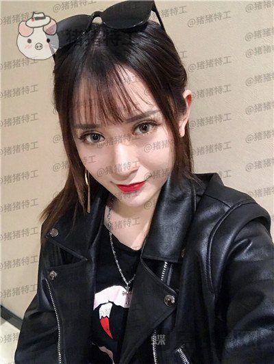 武汉华美马行鼻部手术案例价格分享,一个好看的鼻子有多重要看了就知道!