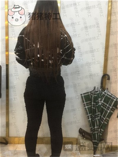 成都军大蒲小兵吸脂瘦腿案例价格分享,感谢医生给了我一双这么完美的腿!
