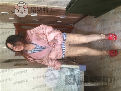 成都军大蒲小兵吸脂瘦腿案例价格分享,感谢医生给了我一双这么完美的腿!