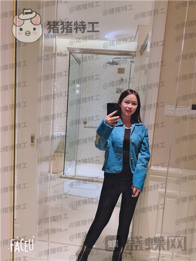 成都军大蒲小兵吸脂瘦腿案例价格分享,感谢医生给了我一双这么完美的腿!