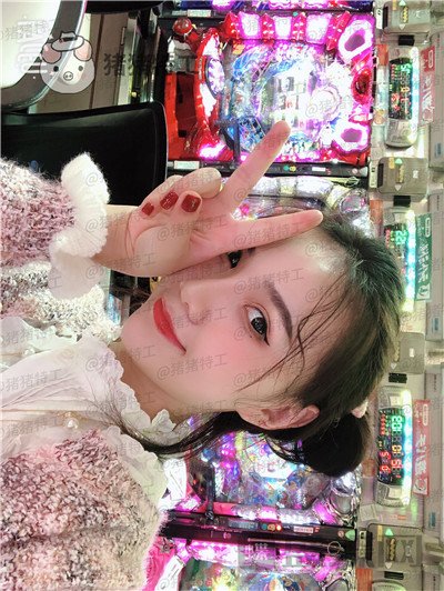 上海愉悦美联臣荣峥鼻部手术案例价格分享,让我嫌弃的鼻子终于给我自信了!