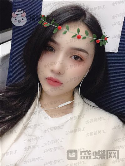 上海愉悦美联臣荣峥鼻部手术案例价格分享,让我嫌弃的鼻子终于给我自信了!