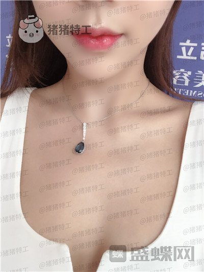 长沙美沃孔伟立厚唇改薄案例价格分享,一个好看的嘴巴让整个人变得可爱!