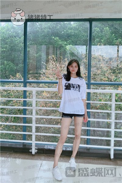 成都军大成应龙全身吸脂案例价格分享,肉感小姐姐变成腿精了解一下。