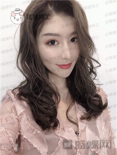 重庆中民整形科孙刚鼻部手术案例价格分享,本来就是小仙女做了鼻子气质升级。