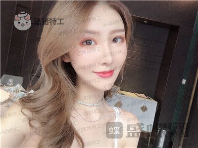 重庆中民整形科孙刚鼻部手术案例价格分享,本来就是小仙女做了鼻子气质升级。